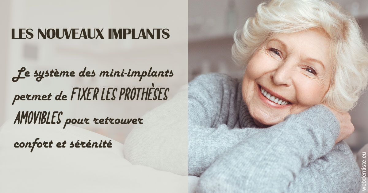 https://dr-lambert-philippe.chirurgiens-dentistes.fr/Les nouveaux implants 1