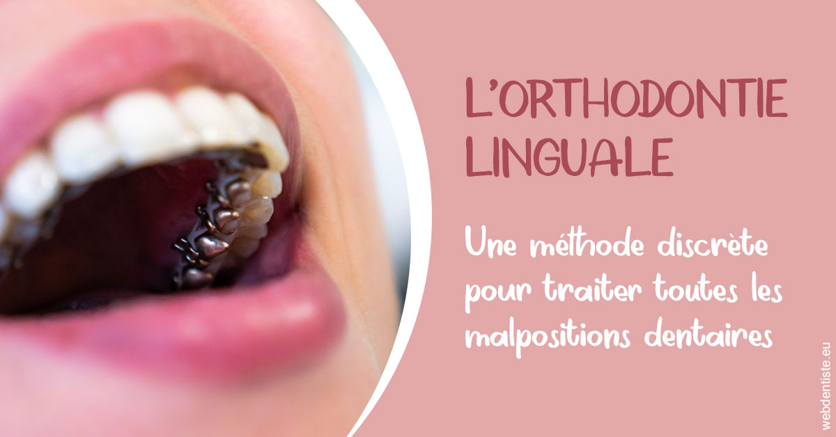 https://dr-lambert-philippe.chirurgiens-dentistes.fr/L'orthodontie linguale 2