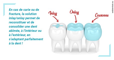 https://dr-lambert-philippe.chirurgiens-dentistes.fr/L'INLAY ou l'ONLAY