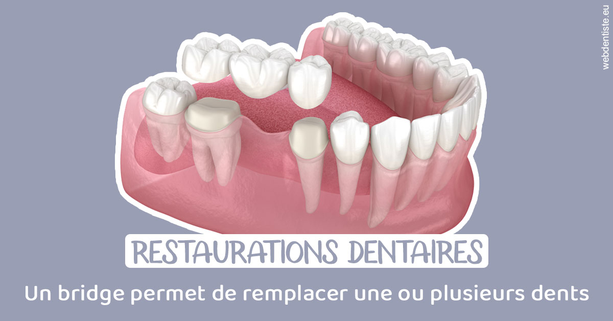 https://dr-lambert-philippe.chirurgiens-dentistes.fr/Bridge remplacer dents 1