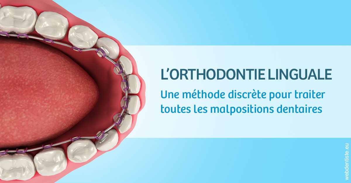 https://dr-lambert-philippe.chirurgiens-dentistes.fr/L'orthodontie linguale 1