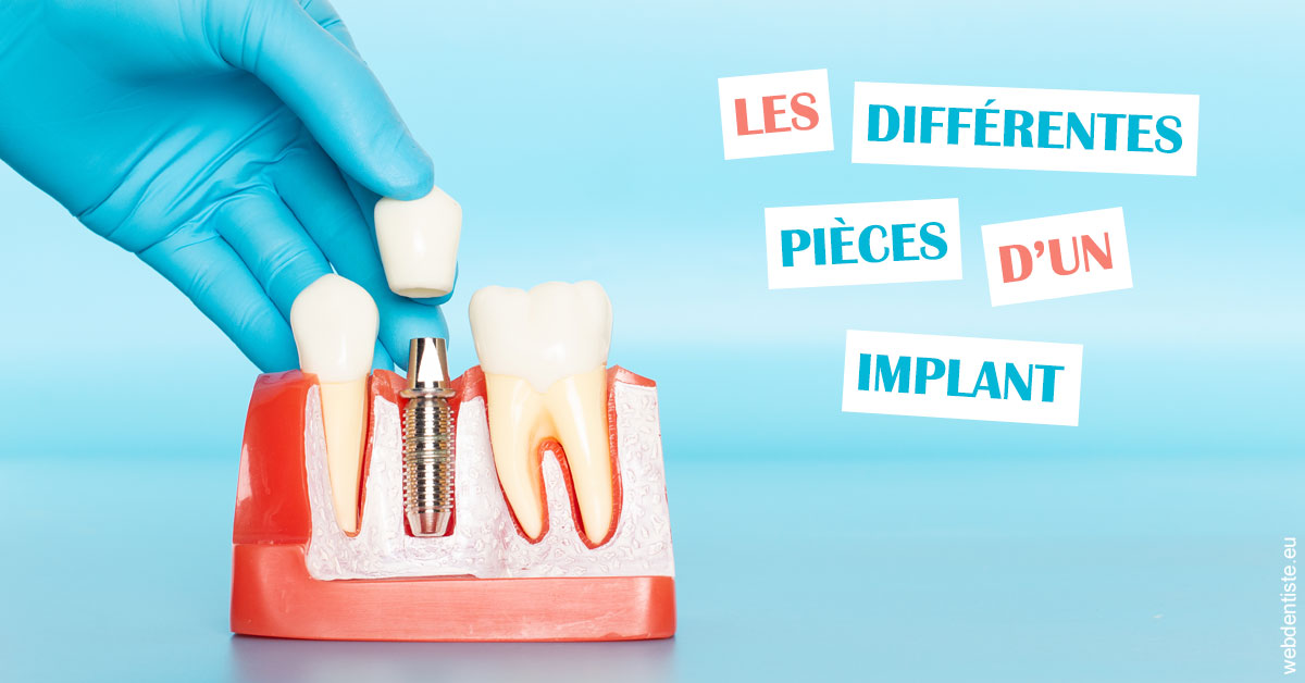 https://dr-lambert-philippe.chirurgiens-dentistes.fr/Les différentes pièces d’un implant 2